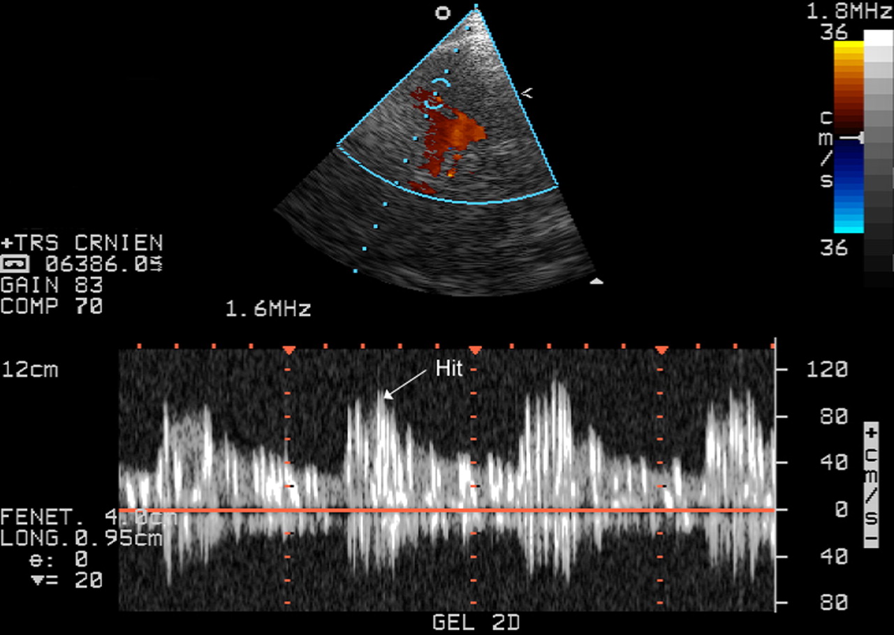 خرید دستگاه اندازه‌گیری جریان خون در عروق مغزی برای بیمارستان گراش