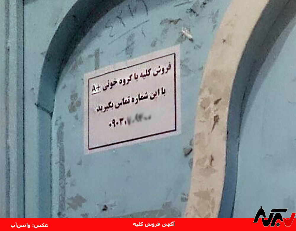 زنی که برای فروش کلیه آگهی داده است