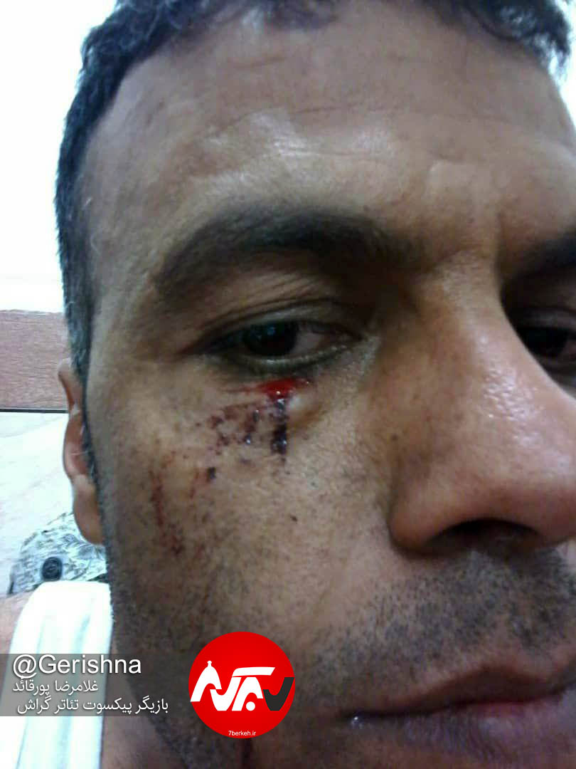 حمله با تفنگ بادی به صف اشقیا