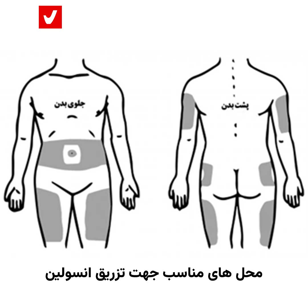 14040612 Davachi 13 Insulin02