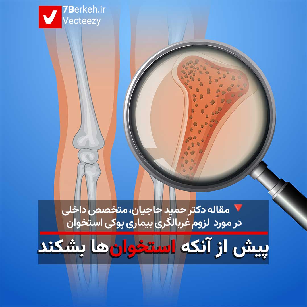 پیش از آنکه استخوان‌ها بشکند / لزوم غربالگری بیماری پوکی استخوان